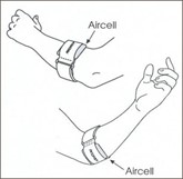 Tennis Elbow (Lateral Epicondylosis) - Idaho Shoulder to Hand